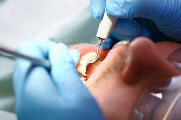 Best Knocked-Out Tooth Emergency  in New Canaan, CT